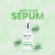 Hammé Naturals Anti-Acne Skin Serum – Prevent Breakouts (30ml)